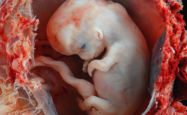 Embryo in der 10. Schwangerschaftswoche / Flickr.com / Lunar caustic