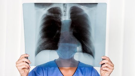 Umfrage: Hohe Mitarbeiter-Zufriedenheit bei Barmherzigen Brüdern