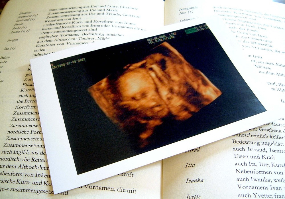 Bild einer Ultraschalluntersuchung eines ungeborenen Kindes bei einer schwangeren Frau, in neuester dreidimensionaler Technik, Foto liegt auf einem Buch mit tausenden Vornamen zum AussuchenSchwangerschaft,Gesundheitswesen,Frauenarzt,Kinder,Neugebor