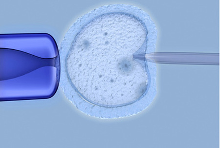 Juan Gärtner / fotolia.com