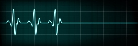 Heart Failure / Laz'e-Pete - Fotolia.com